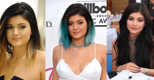 Facts About Kylie Jenner Surgery